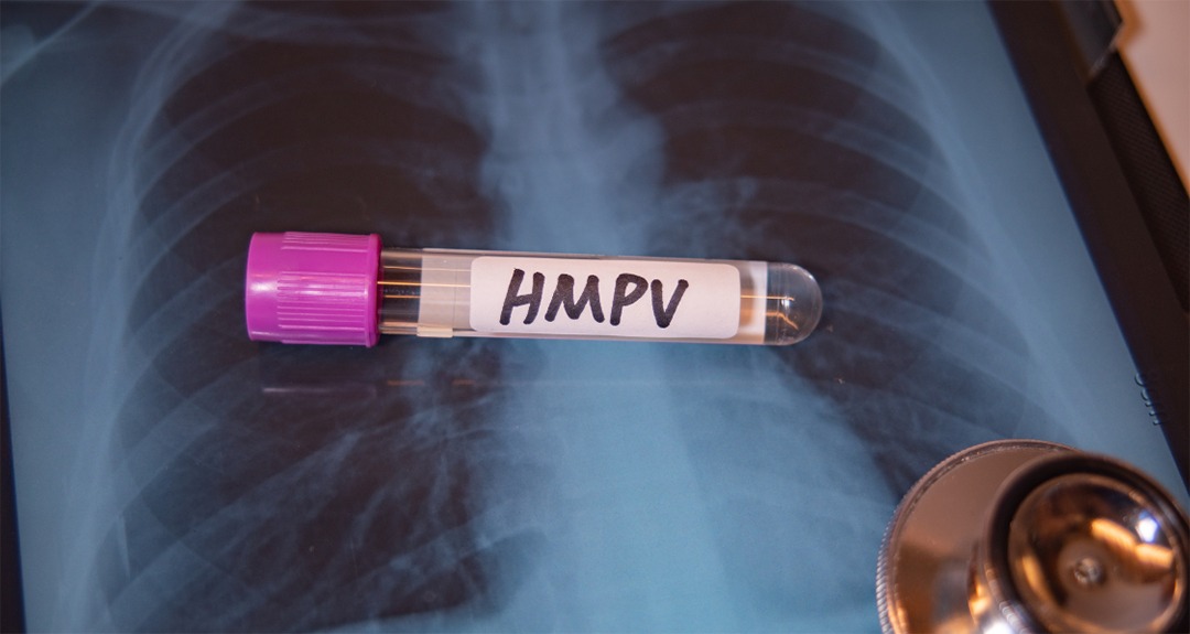HMPV: Everything You Need to Know